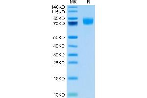 Biotinylated Human ALCAM (Primary Amine Labeling) on Tris-Bis PAGE under reduced condition.