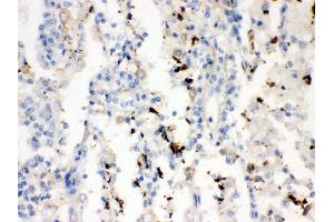 Anti- SFTP A1/2 Picoband antibody, IHC(P) IHC(P): Human Lung Cancer Tissue (SFTPA1/ 2 (AA 206-237), (C-Term) anticorps)
