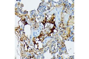Immunohistochemistry of paraffin-embedded rat lung using Fibrinogen alpha chain (FGA) (FGA) Rabbit mAb (ABIN7267177) at dilution of 1:100 (40x lens).