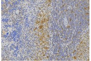 ABIN6273007 at 1/100 staining Human lymph node tissue by IHC-P. (Melanophilin anticorps  (C-Term))