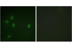 Immunofluorescent staining of NIH/3T3 cells reacted with TP53BP1 (phospho S25) polyclonal antibody  at 1:100-1:500 dilution.