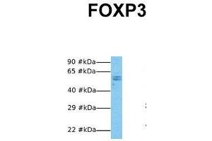Host:  Rabbit  Target Name:  FOXP3  Sample Tissue:  Human NCI-H226  Antibody Dilution:  1.
