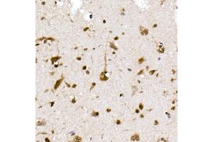 Immunohistochemistry of paraffin-embedded human brain using UB Rabbit mAb (ABIN7271128) at dilution of 1:50 (40x lens). (UBA52 anticorps)