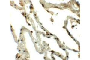 Immunohistochemical staining of human lung cells with TSN polyclonal antibody  at 5 ug/mL.