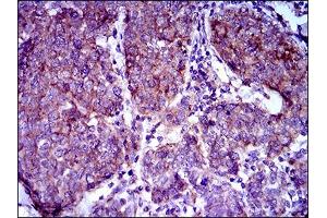 Immunofluorescence analysis of HepG2 cells using ABCB5 antibody (green).