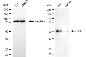 Western blotting analysis using FLT1 antibody (ABIN7798636). (FLT1 anticorps)