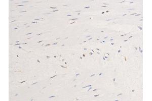 ABIN6267269 at 1/100 staining human heart tissue sections by IHC-P. (EGFR anticorps  (pSer1071))