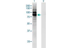 Western Blot analysis of CPXM1 expression in transfected 293T cell line by CPXM1 monoclonal antibody (M02), clone 2G5. (CPXM1 anticorps  (AA 610-718))
