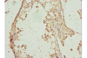 Immunohistochemistry of paraffin-embedded human testis tissue using ABIN7167292 at dilution of 1:100 (RAB31 anticorps  (AA 1-194))