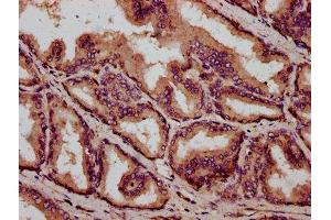 IHC image of ABIN7166787 diluted at 1:400 and staining in paraffin-embedded human prostate tissue performed on a Leica BondTM system.