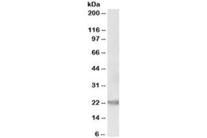 Western blot testing of human prostate lysate with IL-25 antibody at 0. (IL-25 anticorps)