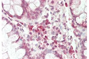 Rabbit Anti-Pou3f1 antibody Catalog Number: ARP33060 Formalin Fixed Paraffin Embedded Tissue: Human Small Intestine Primary antibody Concentration: 1:100 Secondary Antibody: Donkey anti-Rabbit-Cy3 Secondary Antibody Concentration: 1:200 Magnification: 20x Exposure Time: 0.