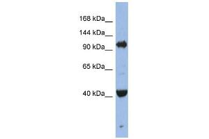 EIF2C4 antibody used at 1 ug/ml to detect target protein. (AGO4 anticorps  (Middle Region))