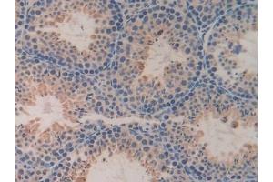 Detection of DDT in Mouse Testis Tissue using Polyclonal Antibody to D-Dopachrome Tautomerase (DDT)