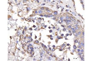 IHC analysis of DLST using anti-DLST antibody (ABIN7599412). (DLST anticorps  (AA 1-453))