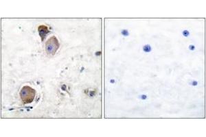 Immunohistochemistry analysis of paraffin-embedded human brain, using Lyn (Phospho-Tyr507) Antibody.