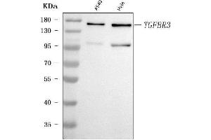 Western blot analysis of TGF Beta Receptor III/TGFBR3 using anti-TGF Beta Receptor III/TGFBR3 antibody (ABIN7601517).