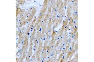 Immunohistochemical analysis of Sorcin staining in rat heart formalin fixed paraffin embedded tissue section. (SRI anticorps)