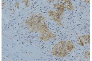 ABIN6266627 at 1/100 staining Human uterus tissue by IHC-P. (Prostate Specific Antigen anticorps  (Internal Region))