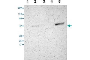Western blot analysis of Lane 1: RT-4, Lane 2: U-251 MG, Lane 3: Human Plasma, Lane 4: Liver, Lane 5: Tonsil with TRAF1 polyclonal antibody . (TRAF1 anticorps)