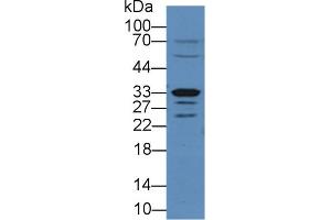 Detection of Arg2 in Rat Small intestine lysate using Polyclonal Antibody to Arginase II (Arg2)