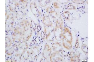 Formalin-fixed and paraffin embedded human kidney labeled with Rabbit Anti-eNOS (Ser1177) Polyclonal Antibody, Unconjugated 1:200 followed by conjugation to the secondary antibody and DAB staining