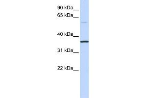 WB Suggested Anti-C16orf46 Antibody Titration: 0. (C16ORF46 anticorps  (N-Term))