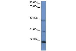 Western Blot showing IMMP2L antibody used at a concentration of 1-2 ug/ml to detect its target protein.
