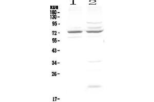 Western blot analysis of CHM using anti-CHM antibody .