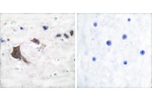 Peptide - +Immunohistochemical analysis of paraffin-embedded human brain tissue using ERAB antibody. (HSD17B10 anticorps)