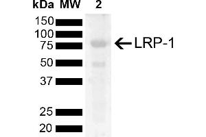 Western blot analysis of Rat Kidney showing detection of 504. (LRP1 anticorps  (AA 2880-2980) (Biotin))