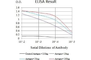 Black line: Control Antigen (100 ng),Purple line: Antigen (10 ng), Blue line: Antigen (50 ng), Red line:Antigen (100 ng)