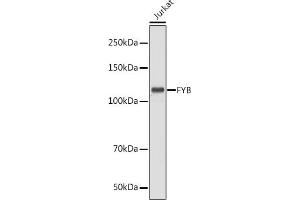 Western blot analysis of extracts of Jurkat cells, using FYB antibody (ABIN7267283) at 1:1000 dilution.