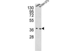 Western blot analysis of OGG1 Antibody (C-term) in Hela, NIH-3T3 cell line lysates (35ug/lane). (OGG1 anticorps  (C-Term))