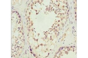 Immunohistochemistry of paraffin-embedded human testis tissue using ABIN7170027 at dilution of 1:100 (SLC9A6 anticorps  (AA 510-669))