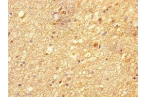 Immunohistochemistry of paraffin-embedded human brain tissue using ABIN7169120 at dilution of 1:100 (NIM1 anticorps  (AA 1-436))