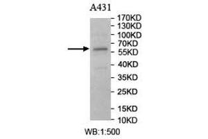 Western Blotting (WB) image for anti-Carnosine Dipeptidase 1 (Metallopeptidase M20 Family) (CNDP1) antibody (ABIN5907141)
