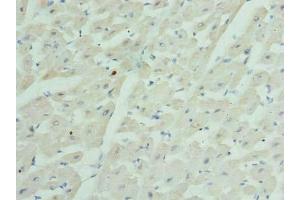 Immunohistochemistry of paraffin-embedded human heart tissue using ABIN7153593 at dilution of 1:100