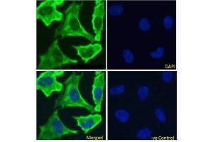 Immunofluoresence staining of fixed HeLa cells with anti-EGFR antibody 528. (Recombinant EGFR anticorps)