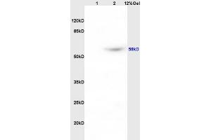 Lane 1: rat brain lysates Lane 2: rat heart lysates probed with Anti PACAP R1/PACAP receptor 1 Polyclonal Antibody, Unconjugated (ABIN726185) at 1:200 in 4 °C.