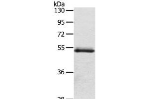 Western Blot analysis of Human normal colon sigmoideum tissue using OLFM4 Polyclonal Antibody at dilution of 1:200