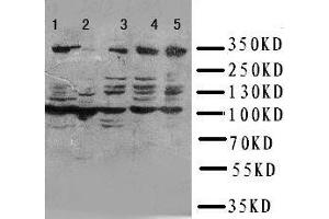 Anti-ATM antibody, Western blotting Lane 1: HELA Cell Lysate Lane 2: SMMC Cell Lysate Lane 3: U87 Cell Lysate Lane 4: A549 Cell Lysate Lane 5: MCF-7 Cell Lysate (ATM anticorps  (N-Term))