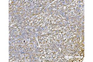 IHC analysis of Poliovirus Receptor/PVR using anti-Poliovirus Receptor/PVR antibody (ABIN7601077). (Poliovirus Receptor anticorps  (AA 28-417))