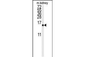 Western blot analysis of anti-LSM1 Antibody in mouse kidney tissue lysates (35ug/lane) (LSM1 anticorps  (AA 33-61))