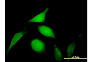 Immunofluorescence of purified MaxPab antibody to PSMD14 on HeLa cell.