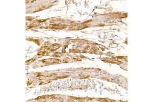 Immunohistochemistry of paraffin-embedded mouse heart using COX7 Rabbit pAb (4721) at dilution of 1:100 (40x lens).