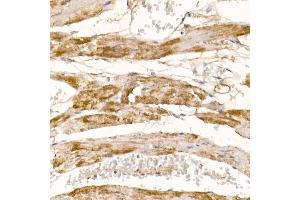 Immunohistochemistry of paraffin-embedded mouse heart using COX7 Rabbit pAb (4721) at dilution of 1:100 (40x lens). (COX7A1 anticorps  (AA 1-79))