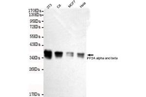 Western blot detection of A alpha and beta in Hela,MCF7,C6 and 3T3 cell lysates using A alpha and beta mouse mAb (1:2000 diluted). (PP2A alpha/beta anticorps)