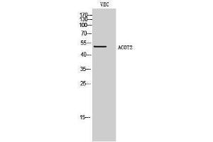 Western Blotting (WB) image for anti-Acyl-CoA Thioesterase 2 (ACOT2) (Internal Region) antibody (ABIN3183148)