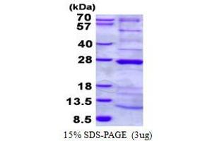 Image no. 1 for NADH Dehydrogenase (Ubiquinone) 1 alpha Subcomplex, Assembly Factor 4 (NDUFAF4) (AA 1-175) protein (His tag) (ABIN6387055)